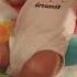 Down Syndrome Abriana S Journey Abriana Rolling Over