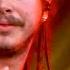 Post Malone Too Young Live From Jimmy Kimmel Live