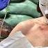 Frontline ER Inside Ukraine S Makeshift Combat Hospitals Frontline Daily Mail