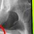 The Most Shocking Sex Injuries PART 2