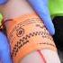 Stop The Bleed With A Special Rubber Band Ambulance Paramedic Emergency Hospital Firstaid