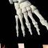 Ankle Injury Ankle Fracture Animated Broken Ankles