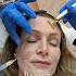 Sculptra Beverly Wilshire Clinic PJ Theyumlist Sculptra Beauty Aesthetictreatments