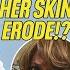 Ann Marie S Skin ERODED After Breast Cancer Removal Before After Botched E