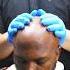 Bald Head Shave Treatment Refreshing Exfoliation