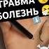 Хиромантия знак СМЕРТИ Болезнь Травма