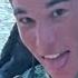 Keep Praying For Him Young Surfer Faces Grueling Recovery After North Shore Crash