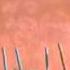 Pink Floyd Comfortably Numb Demo Version