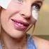 Smile Lines Crow S Feet Anti Aging Eye Mask To The Rescue Skincare Faceserumforoilyskin