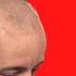 Before You Shave Your Head For A Hair System Watch This First LaVivid Hair System