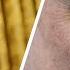 Elon Musk Reveals Who Punched Him In The Face Leaving Him With A Shiner