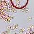 White Blood Cells Fight Infection Under The Microscope RARE FOOTAGE