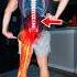 STOP Stretching Sciatica