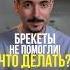Брекеты не помогли