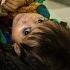 Afghanistan S Hospitals Are Seeing A Dramatic Rise In Malnutrition Cases