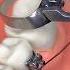 BRACES ORTHODONTICS