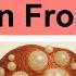 Echinococcosis Disease From Dogs How You Get Sick Signs And Symptoms Diagnosis Treatment