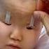 Why Do Chinese Apply Tape On Their Children S Eyes