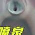 谁能够拒绝一个有前列腺的女生呢 神秘的斯基恩氏腺究竟是什么