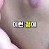 98 가 모르는 이렇게 생긴 점의 위험성