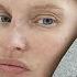 Bianca Balti I M Not Receiving Life Saving Medicines It S A Shame