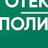 Исцеление отеков тела Полисерозит Артем Толоконин