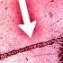 Why The Sex Pilus Is So Dangerous Horizontal Gene Transfer