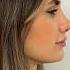 Rhinoplasty Turkey Dr Ahmet Dilber Rhinoplastyturkey Plasticsurgery Nosejob