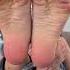 Blonde Wrinkled Soles Feet Foot Toes Wrinkled