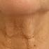 Anti Aging Magic Oil This Oil Will Erase All The Wrinkles On Your Face Stronger Than Botox