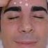 ASMR Chinese Facial Massage For Glowing Skin Shorts