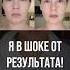 Ух ты 2 минуты и результат от мгновенной подтяжки лица на вашем лице