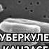 Вспышка туберкулеза в Канзасе Перестрелка с полицией в Коннектикуте Замерзший Ниагарский водопад