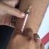 Tb Test Injection Video Useful Lab Student