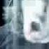 IMPENDING DOOM My Nemesis OFFICIAL VIDEO