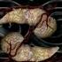 Weird Al Yankovic Pancreas Official Video