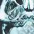 Breaking Benjamin What Lies Beneath
