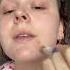 How To Brighten The Look Of Dark Spots Skincare Darkspots Brightening Acneproneskin Acne