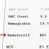 How To Interpret RBC Indices E G Hemoglobin Vs Hematocrit MCV RDW