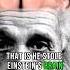 Einstein S Brain Was Stolen After His Death History