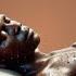 Human African Trypanosomiasis Symptoms You Can T Ignore