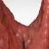 Parathyroid Glands And Hyperparathyroidism Amazing Animation