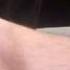 Dorsal Pedal Pulse And Posterior Tibial Artery ST