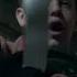 Carl Breaks Frank S Leg Shameless