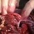 EXistenZ 3 10 Movie CLIP Bio Pod Surgery 1999 HD