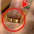 How To Remove A Ring Stuck On Finger