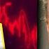 Trump SINKS Global Markets Yet Again