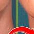 Anti Wrinkle Ingredient That Tightens The Skin And Removes Fine Lines From The Forehead And Neck