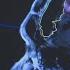 Brain Tumors Stopped With New CTRC Radiation Process