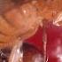 This Freaky Fruit Fly Lays Eggs In Your Strawberries Deep Look